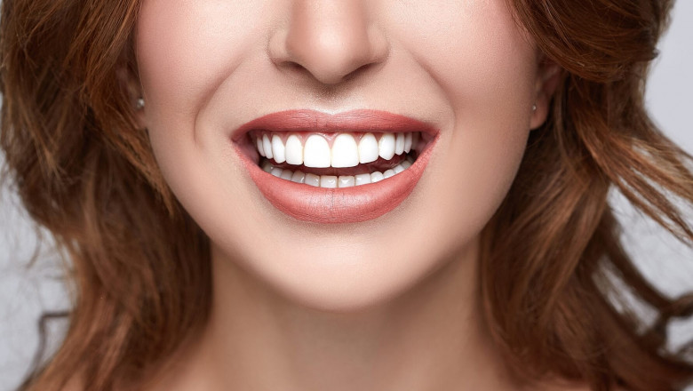 Broken Tooth Filling and Replacement