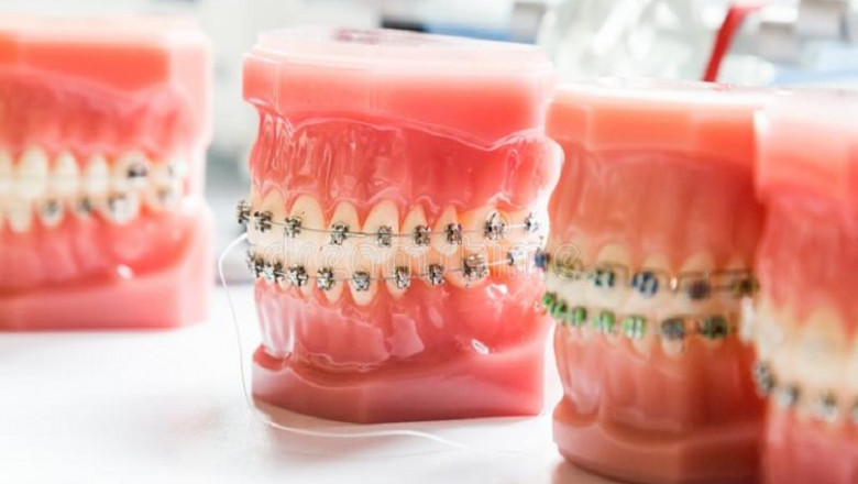 Why Do You Need On-time Treatment for Gingivitis?