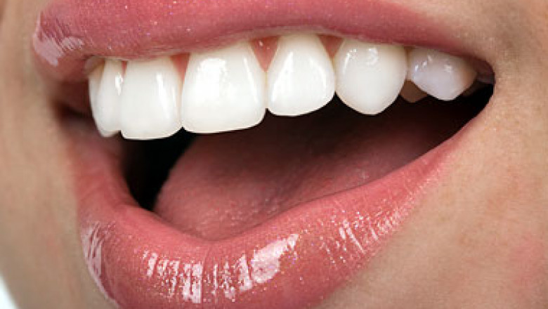 Work on Your Smile with Teeth Whitening Kits