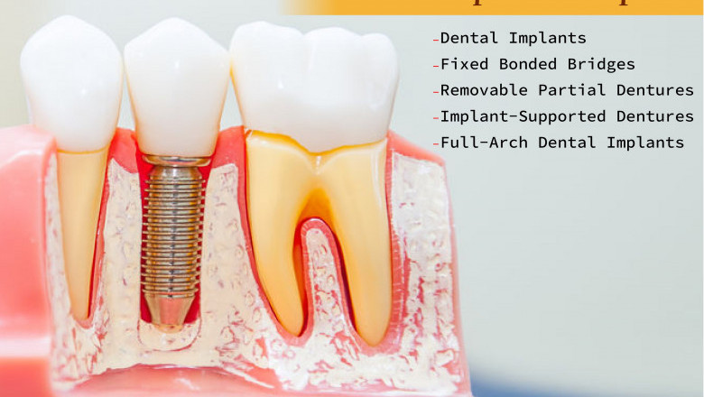 5 Tooth Replacement Options | Emergency Dental Service