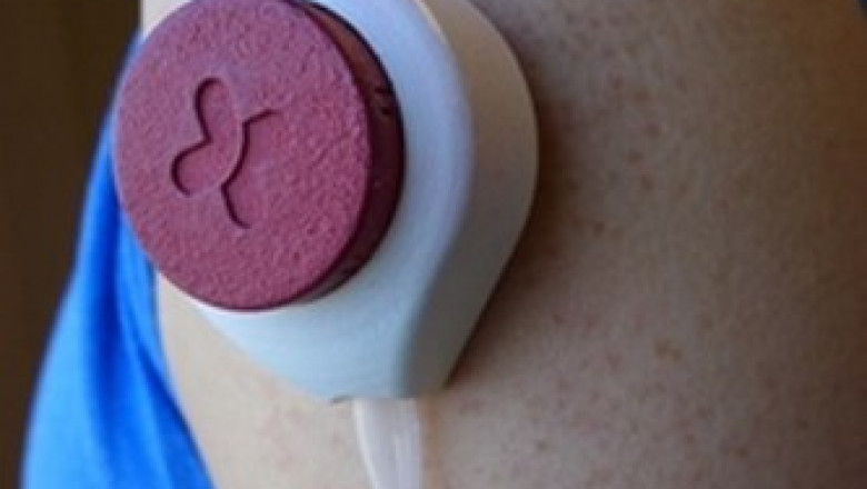 All Needle-free Blood Drawing Devices require that the patient wears an adhesive band around their fingers