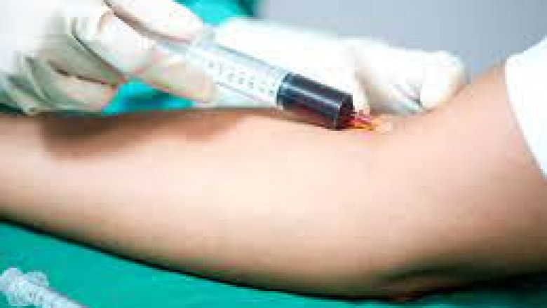 Blood Stream Infection Testing is performed to determine whether or not there is an infection in the bloodstream and, if so, which agent is causing it