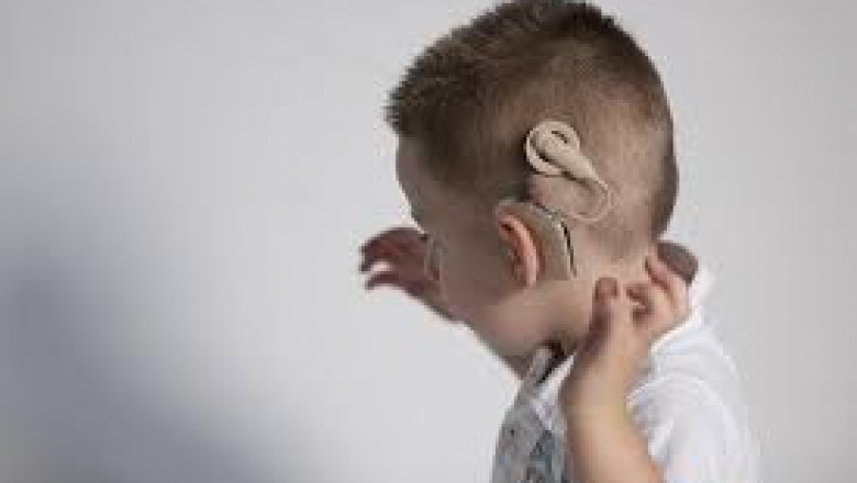 Cochlear Implants: Tiny electronic devices that stimulate cochlear nerves to treat hearing loss