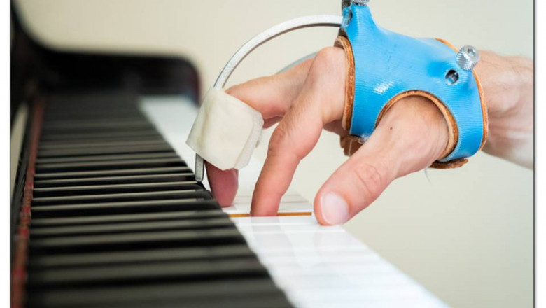 MUSICIAN’S DYSTONIA