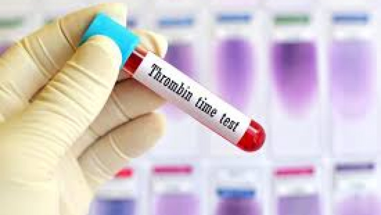 Prothrombin Complex Concentrate Market Forecast to 2028 - COVID-19 Impact and Global Analysis By Product, By Applications, By End-Use