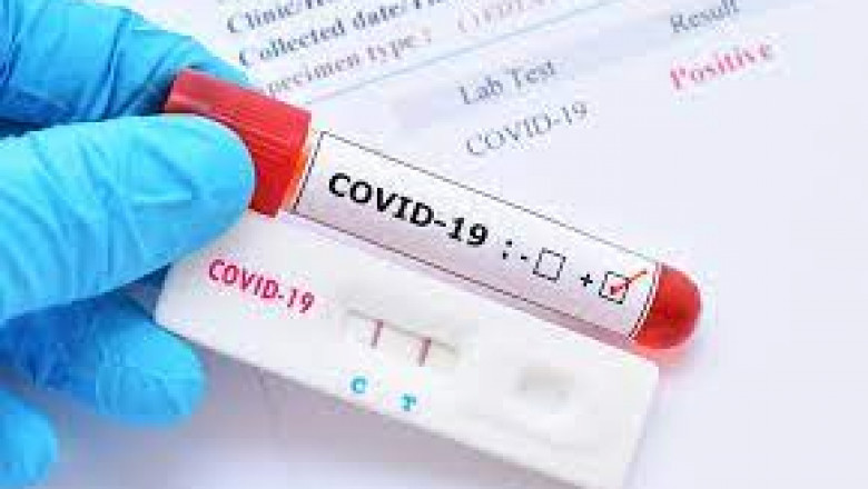 This is expected to boost the testing rates in rural areas as well and thus fuel the growth of global COVID-19 rapid diagnostic test market.