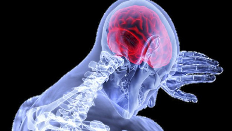 Anaplastic Astrocytoma Treatment, Depending on the Size and Location of the Tumor