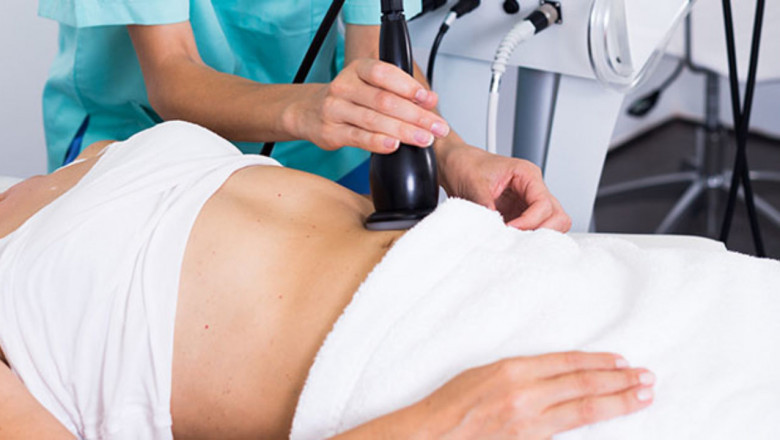 How Much Does Dermaplaning Cost?