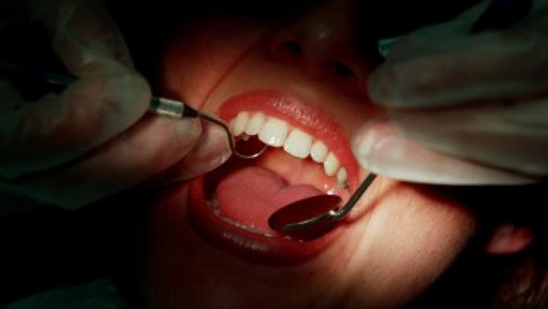Invisalign Treatment: Straighten Teeth Without Braces: