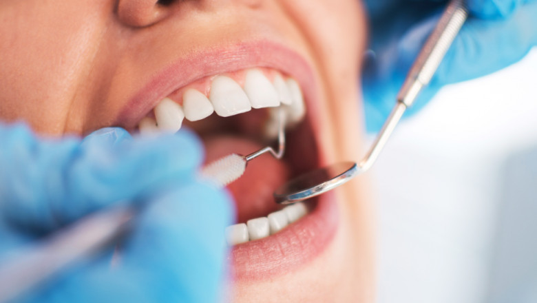 Orthodontist Specialist Near Miami, Fl