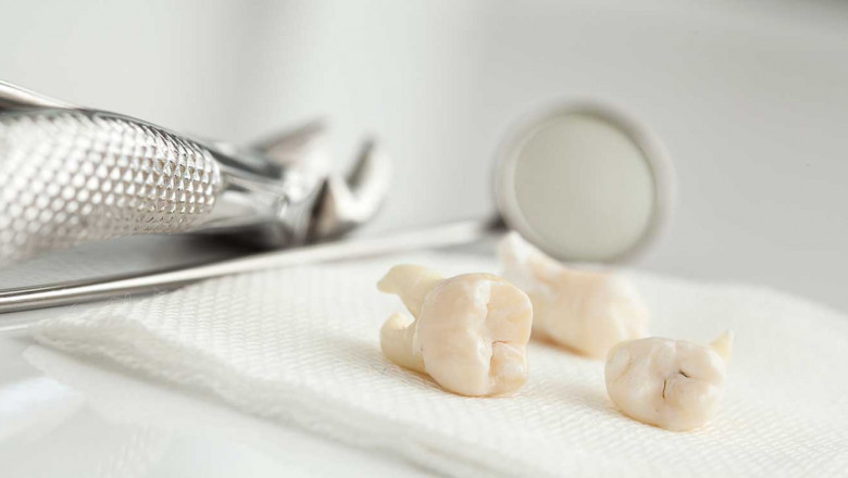 top rated houston dentist
