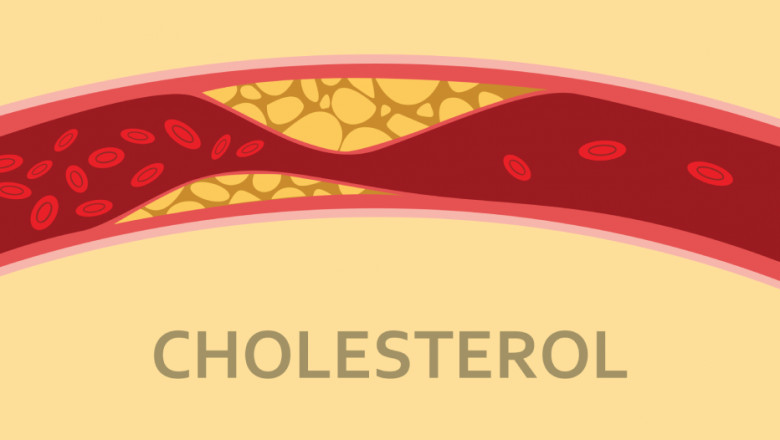 6 Facts About High Cholesterol You Need to Know