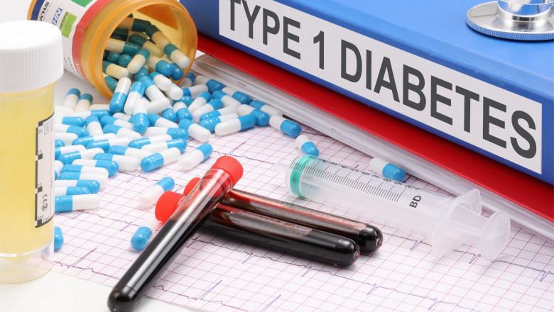 Global Type 1 Diabetes Market By Product Application Manufacturer Sales and Segmentation - Forecast to 2030