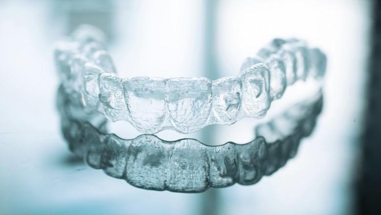 Life With Invisalign: Major Foods You Should Avoid Eating
