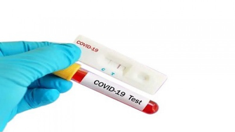 Rapid Test Kit Market to Grow at a Steady CAGR of 8.14% During the Forecast Period | TechSci Research
