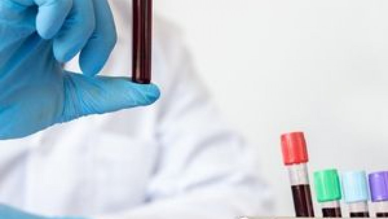 Liquid Biopsy Market Size, Segments, Industry Growth, Emerging Technologies and Trends by 2027