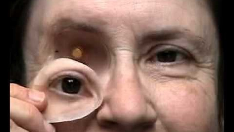 Ocular Implant Market Size, Share, Analysis and Forecast 2021-2026