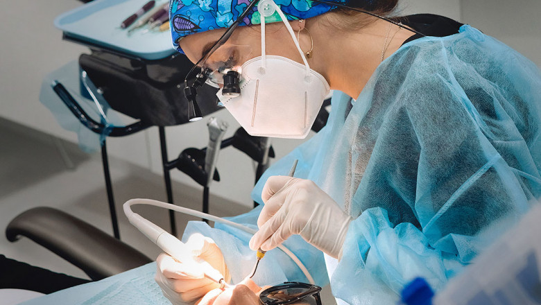 Everything You Need To Know About Root Canal Treatment