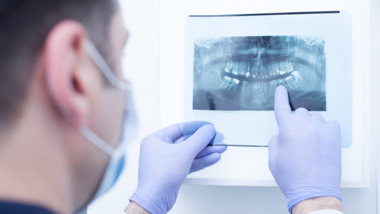 Keep Your Oral Health in Check by Visiting Trusted Dental Clinic