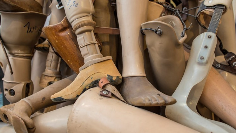 Prosthetic Legs Market Insights and the Future of the Global Industry