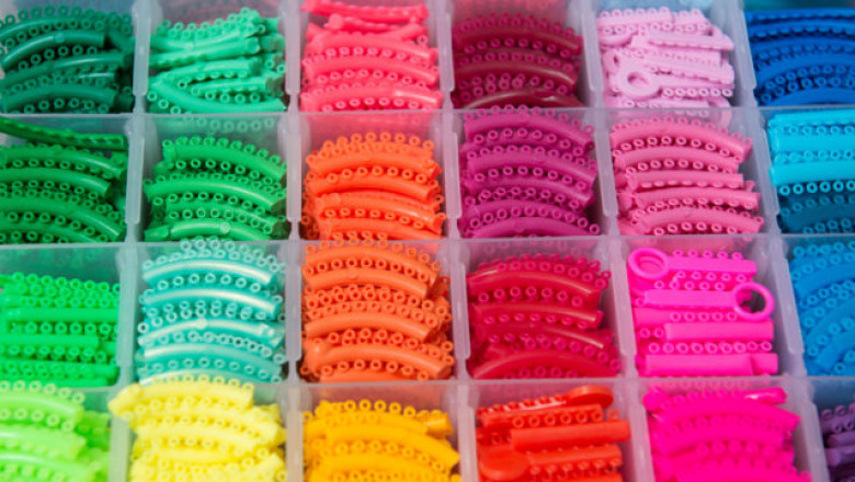 What are the Questions that Arise at the Time of Braces?