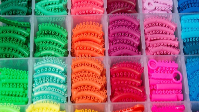 What is the Most Stylish Color for Braces in 2021?