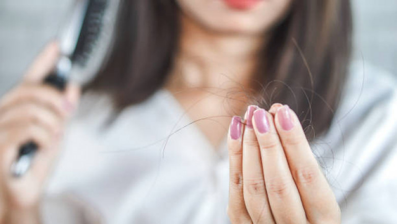 Hair restoration