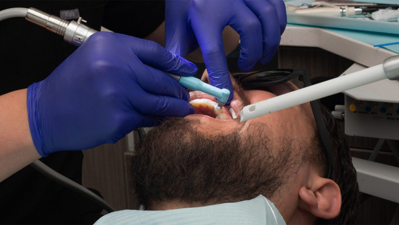 How To Stop Bleeding Gums?