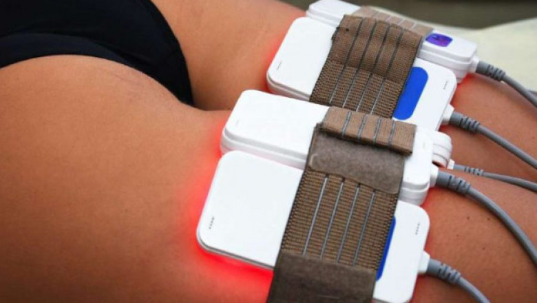 Everything You Need To Know About Lipo Laser
