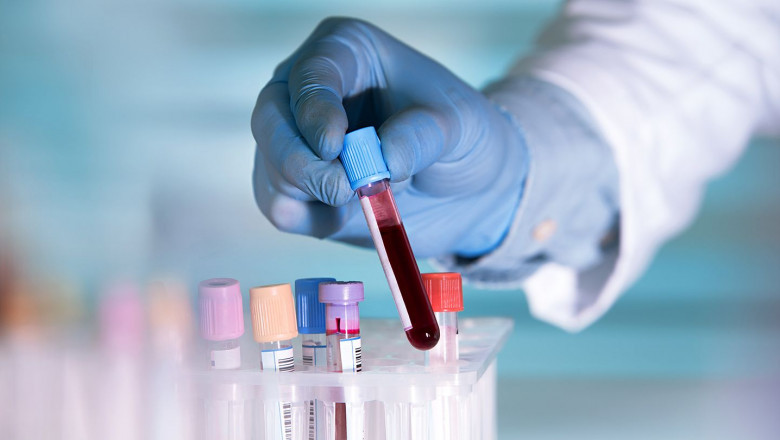 Liquid Biopsy Market revenue to cross USD 10 Bn by 2027