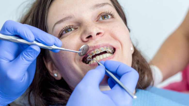 When Do You Require Braces For Kids?