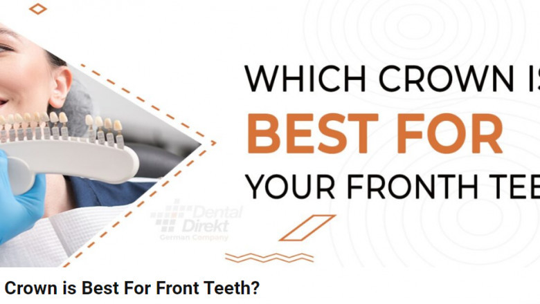 Which Crown is Best For Front Teeth?