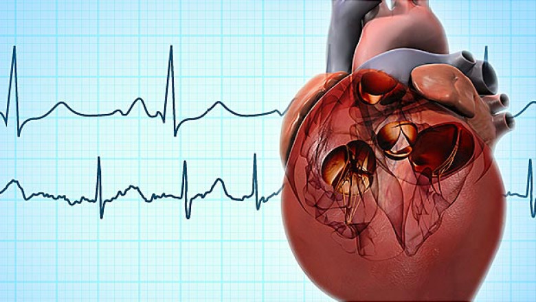Causes of Atrial Fibrillation