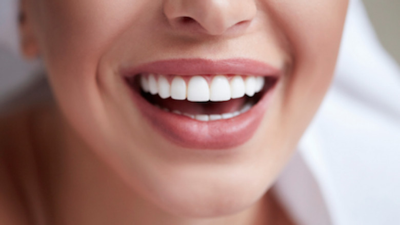 4 Ways to get a Whiter Smile
