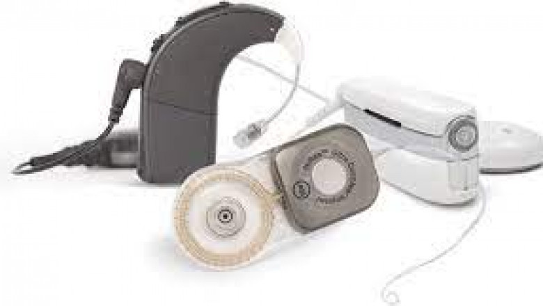 Cochlear Implant (CI) System Market Analysis, drivers, Share, Restraints, Opportunities, Trends, And Growth Forecast to 2026