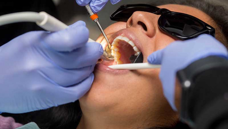 Efficient Tips To Find Teeth Bleaching Services