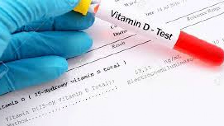 Vitamin D Testing Market Report Analysis, Industry Size And Growth 2026