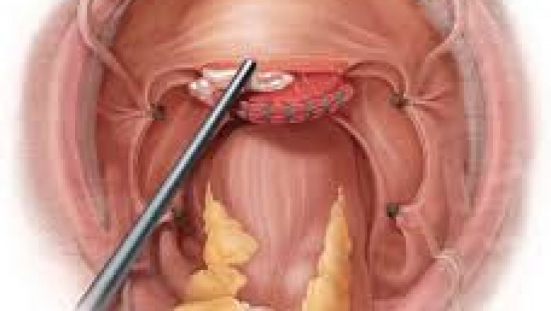 Hemostatic Agents Market Report 2021 by Key Manufacturers, Types, Applications, Forecast To 2026