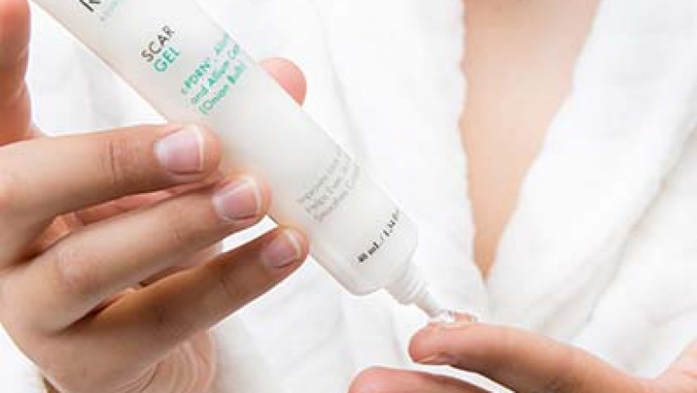 5 Tips to Help Improve the Appearance of Scars