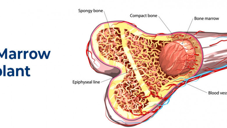 Bone Marrow Transplant Market Trend, Forecast, Drivers, Restraints, Company Profiles and Key Players Analysis by 2027