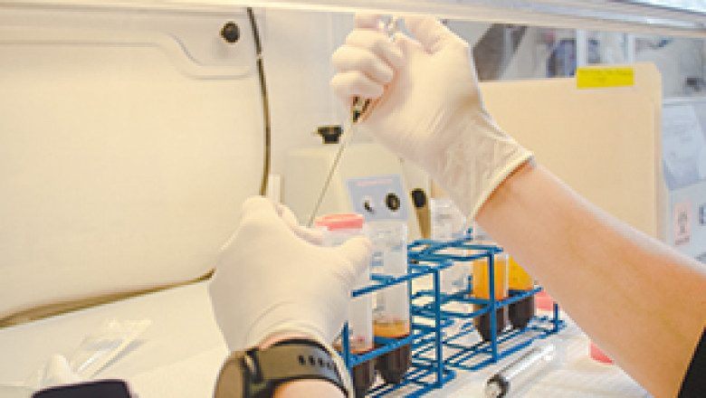 New Approach of Amniotic Products Market 2021: To Business Applications with Top Key Players like Applied Biologics , Lucina BioSciences