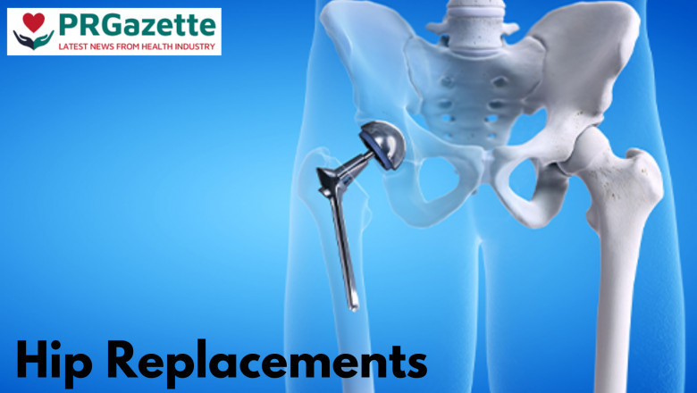 What's new in the world of hip replacements