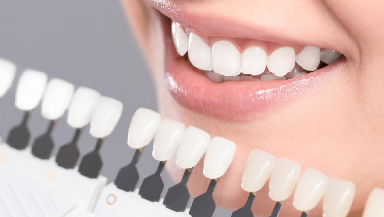 Cosmetic Dentistry Market Emerging Demands, Size & Revenue, Business Prospects to 2028