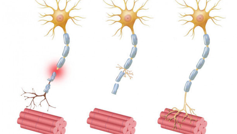Nerve Repair and Regeneration Market Size will Observe Substantial Growth by 2027