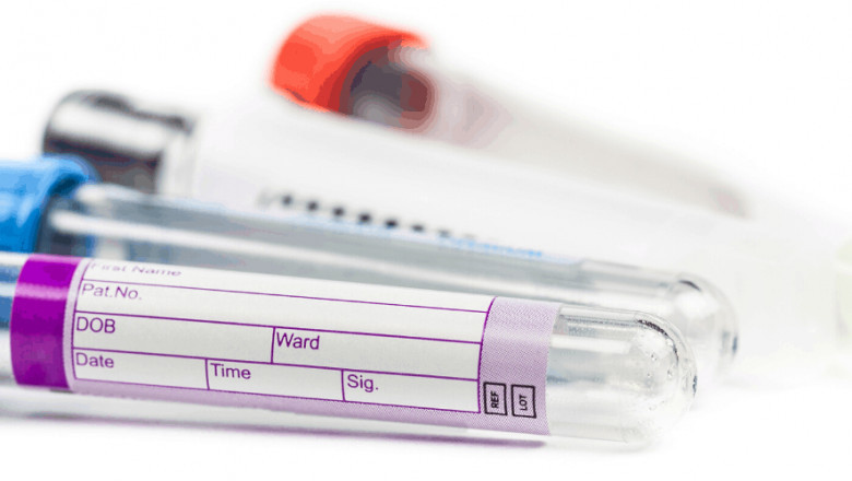 Brief About the types Phlebotomy Tubes