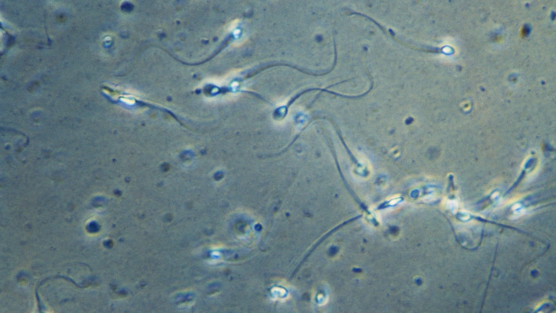 What Should You Do When You Know Your Sperm Is Zero?