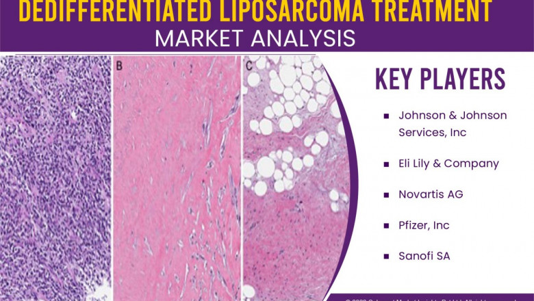 Dedifferentiated Liposarcoma Treatment Market Size Estimated to Exhibit 5% CAGR through 2028, Global Industry Analysis by Drug Type, Treatment, Techniques, Challenges, Opportunities, Top Company Profile Johnson & Johnson Serv