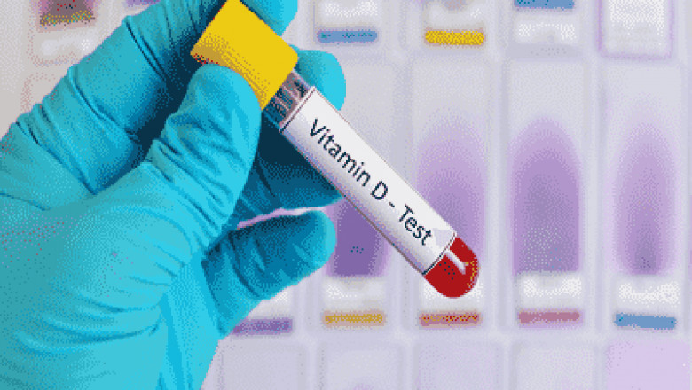 Vitamin D Testing Market: Industry Analysis, Opportunity and Forecast to 2027