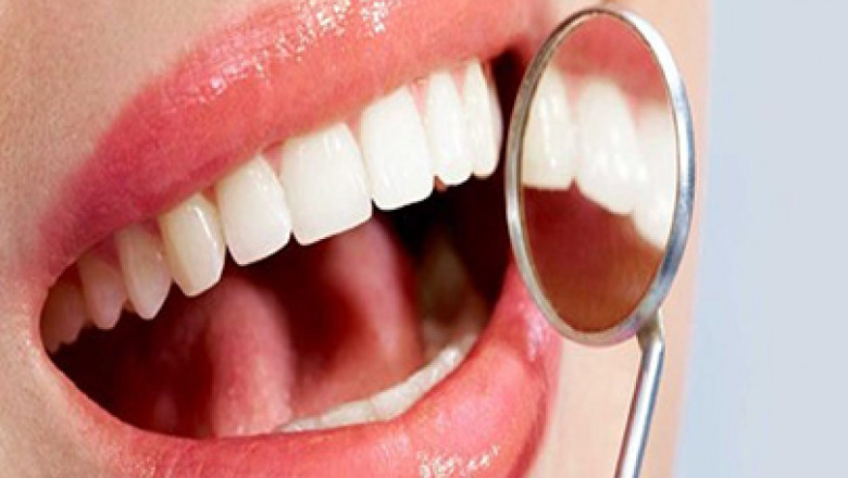 What Is The Procedure Of Root Canal Treatment?