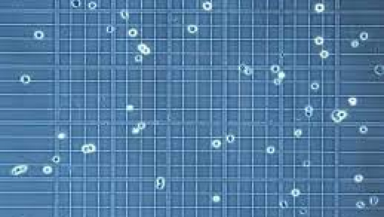 Cell Counting Market Size 2021 | Industry Share, Growth, Trends And Forecast 2026